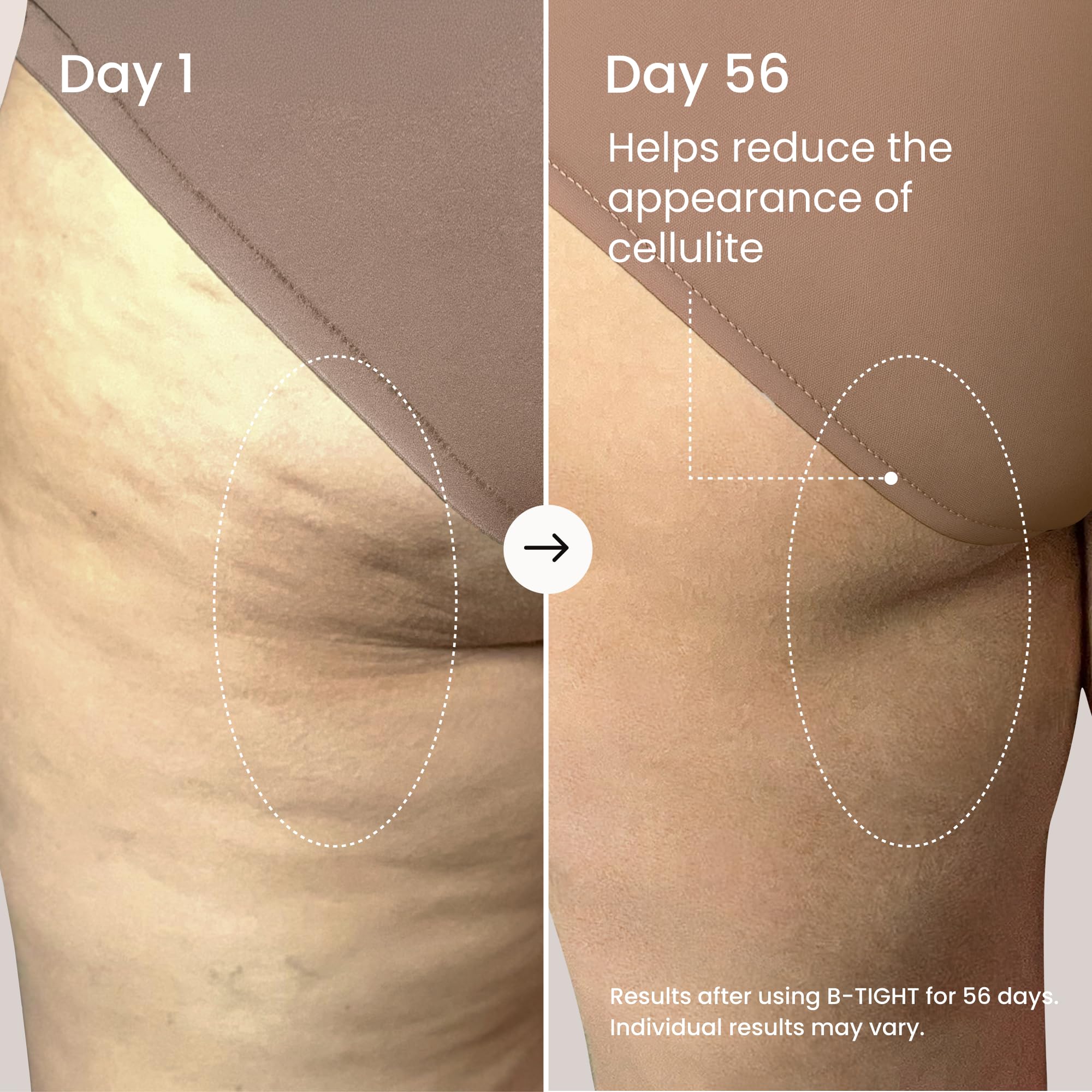 Applying MAËLYS B-TIGHT to skin with a warming, fast-absorbing feel