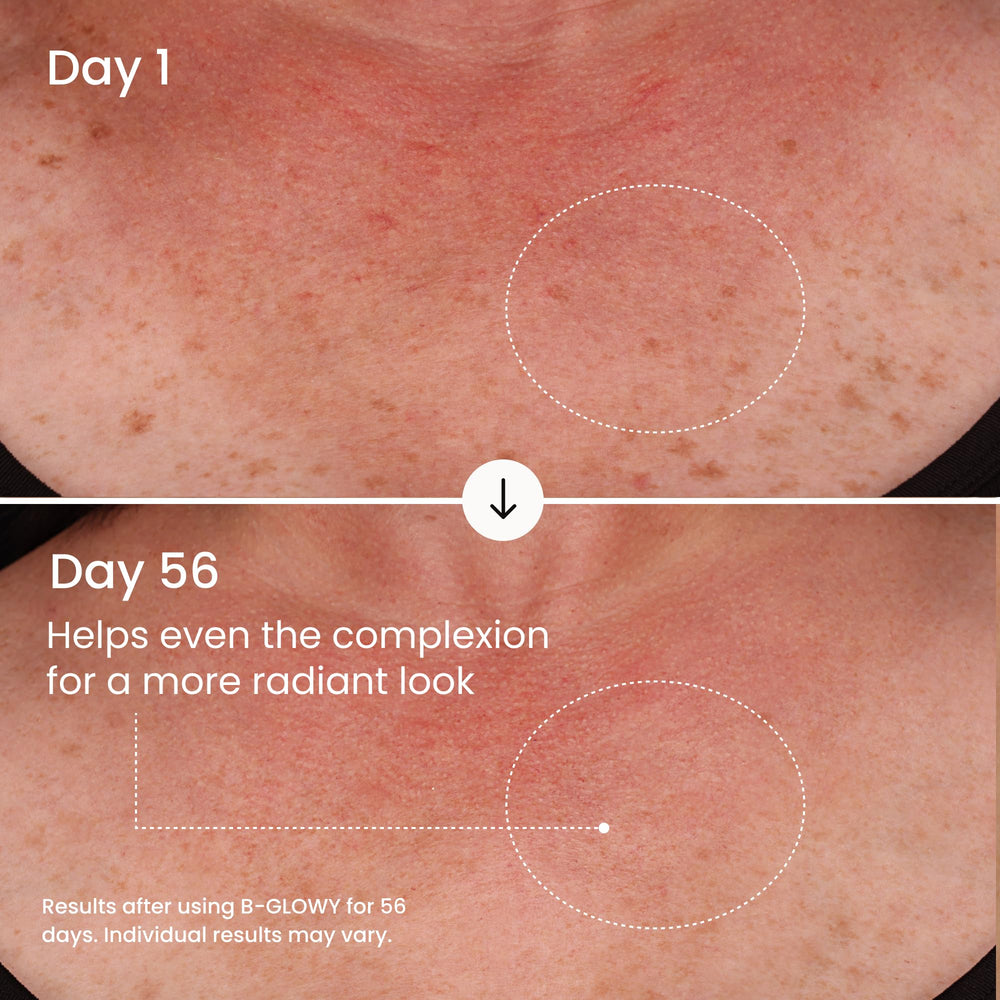 Serum applied on the arm highlighting smooth, even application