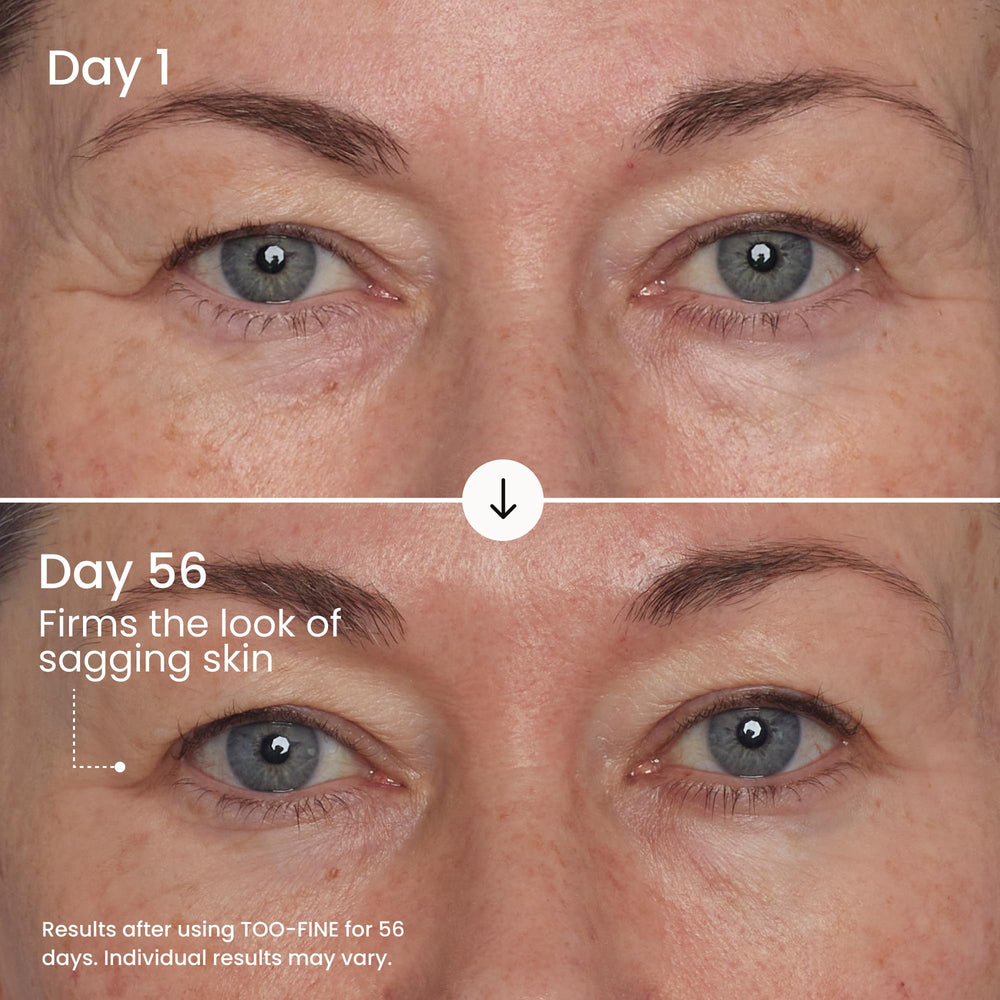 Maelys Too-Fine serum featuring Bacillus ferment for a firmer look.