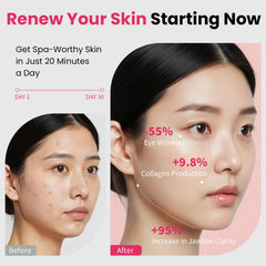 Magivol Face Lift Device with digital controls and LED panel for customization