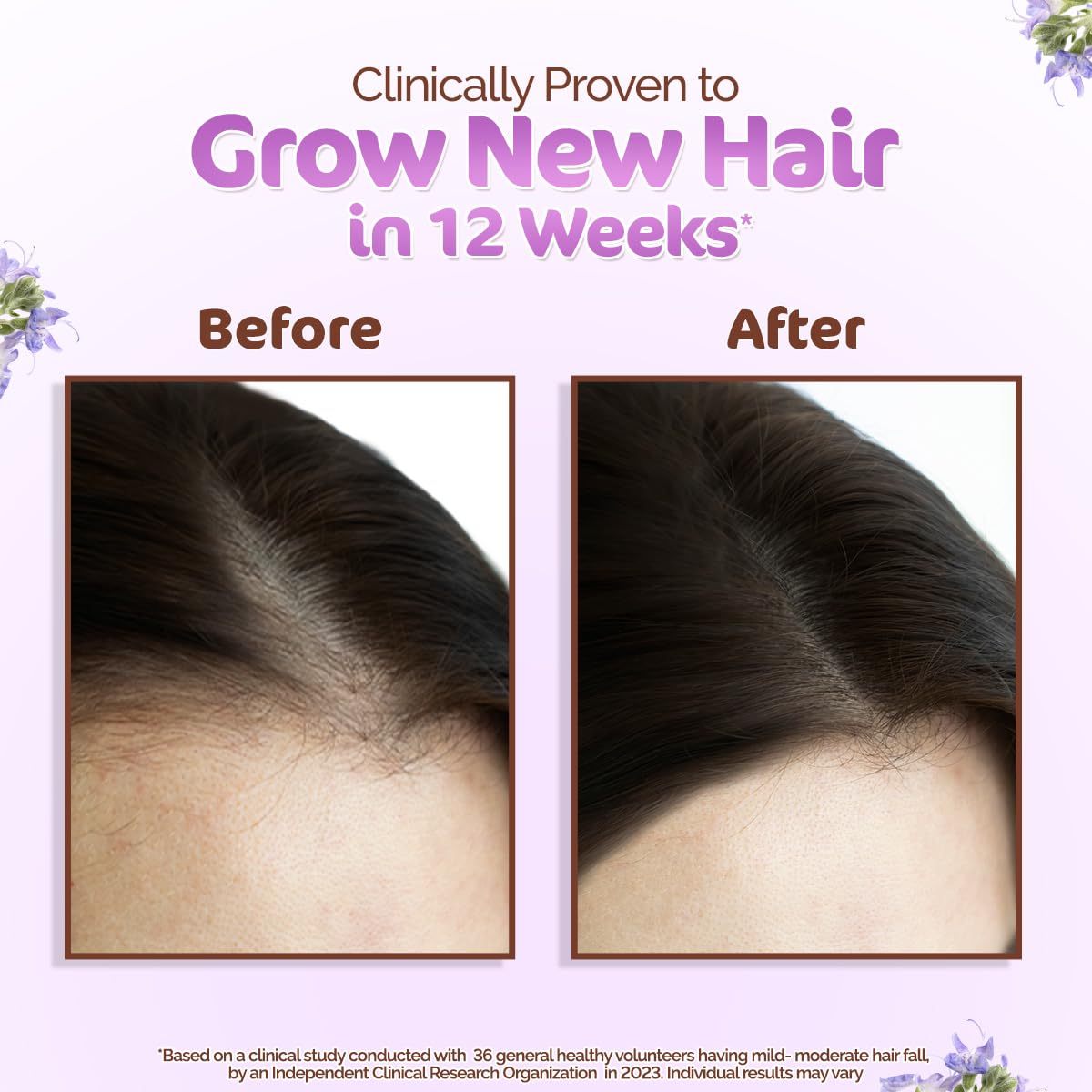 Shiny hair strands after using Mamaearth Rosemary Oil, reflect healthy appearance.