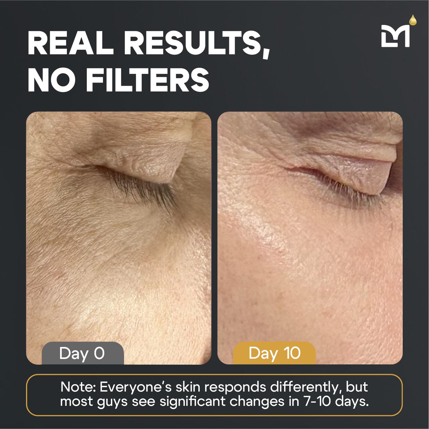Man Labs Titan skincare kit box ready for daily use