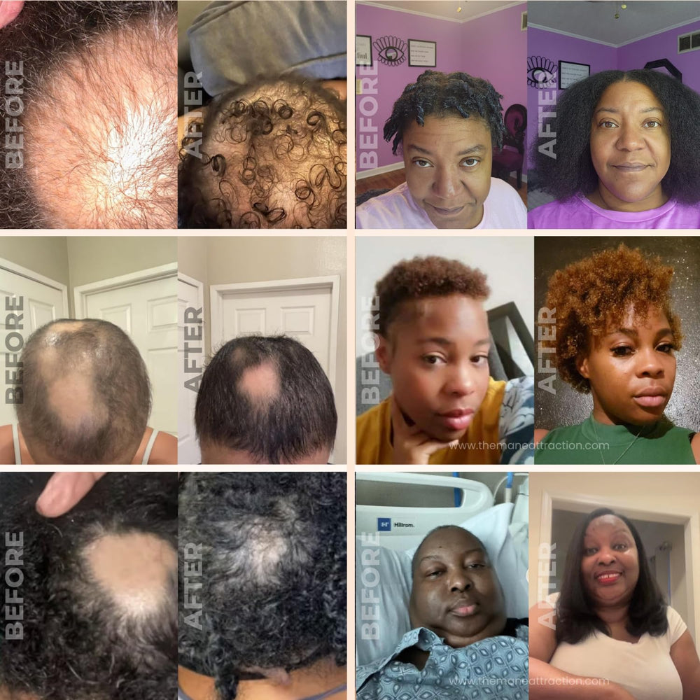 The Mane Attraction oil is shown during scalp application with fast absorption.