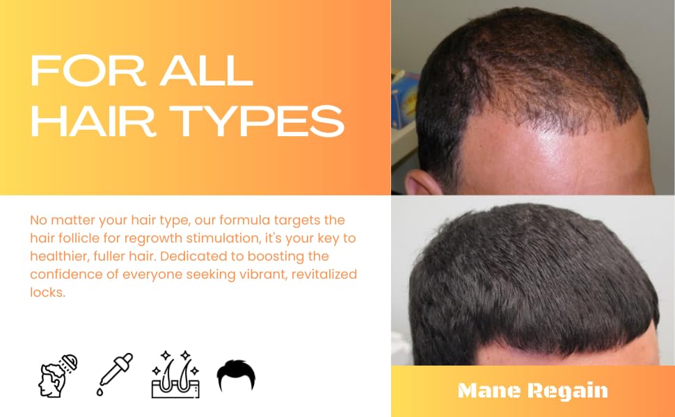 Mane Regain minoxidil dropper shown beside packaging for scalp support