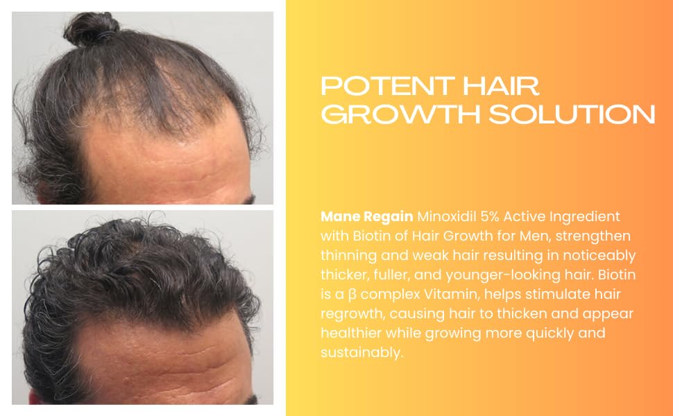Mane Regain Minoxidil 5% for men with crown thinning.