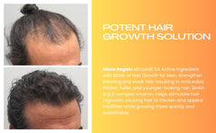 Mane Regain Minoxidil 5% for men with crown thinning.
