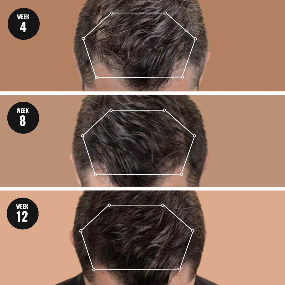 Mane Root Activator formula close-up shows nutrient-rich texture supporting healthy roots.