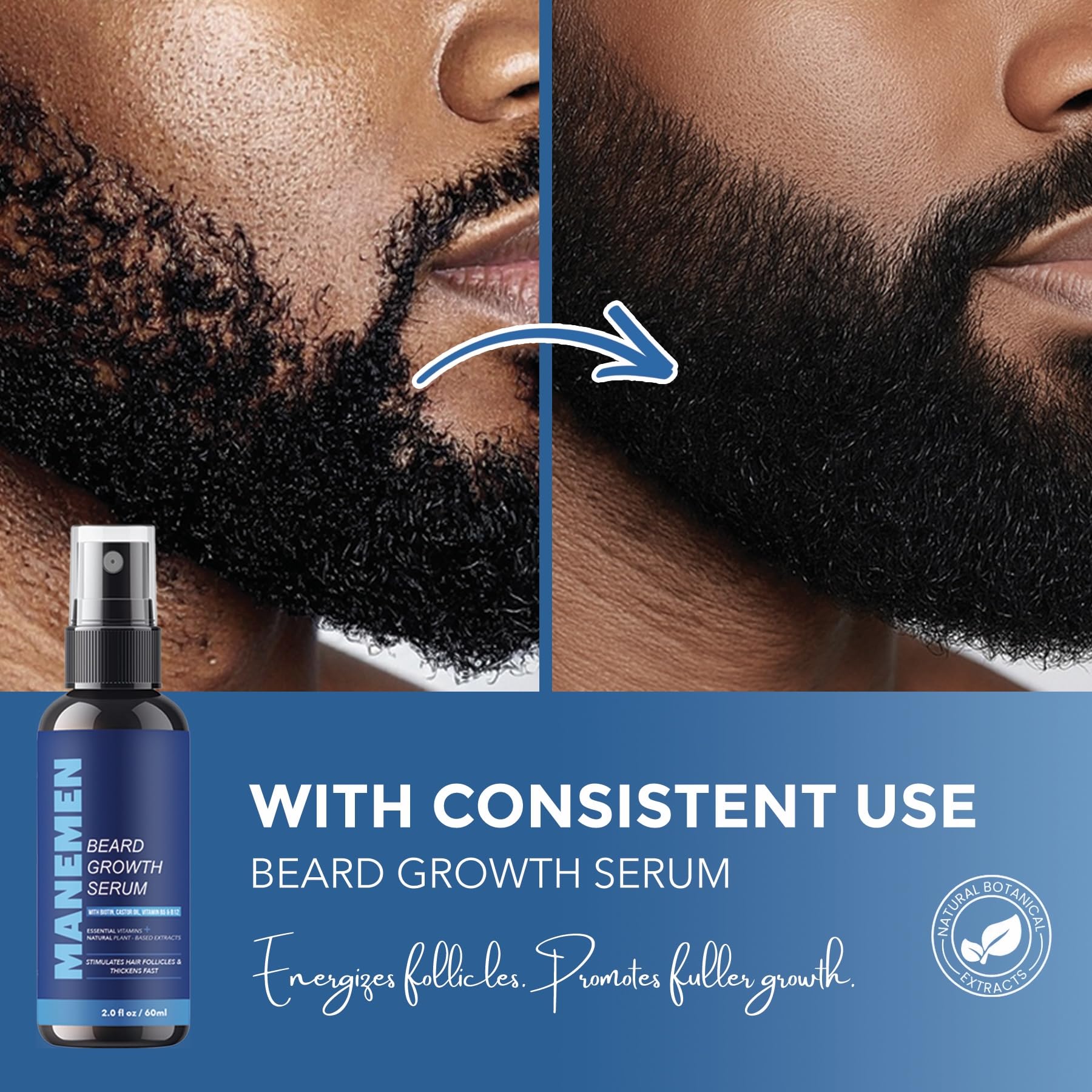 MANEMEN saw-palmetto-rosemary formula shows fortified beard roots.