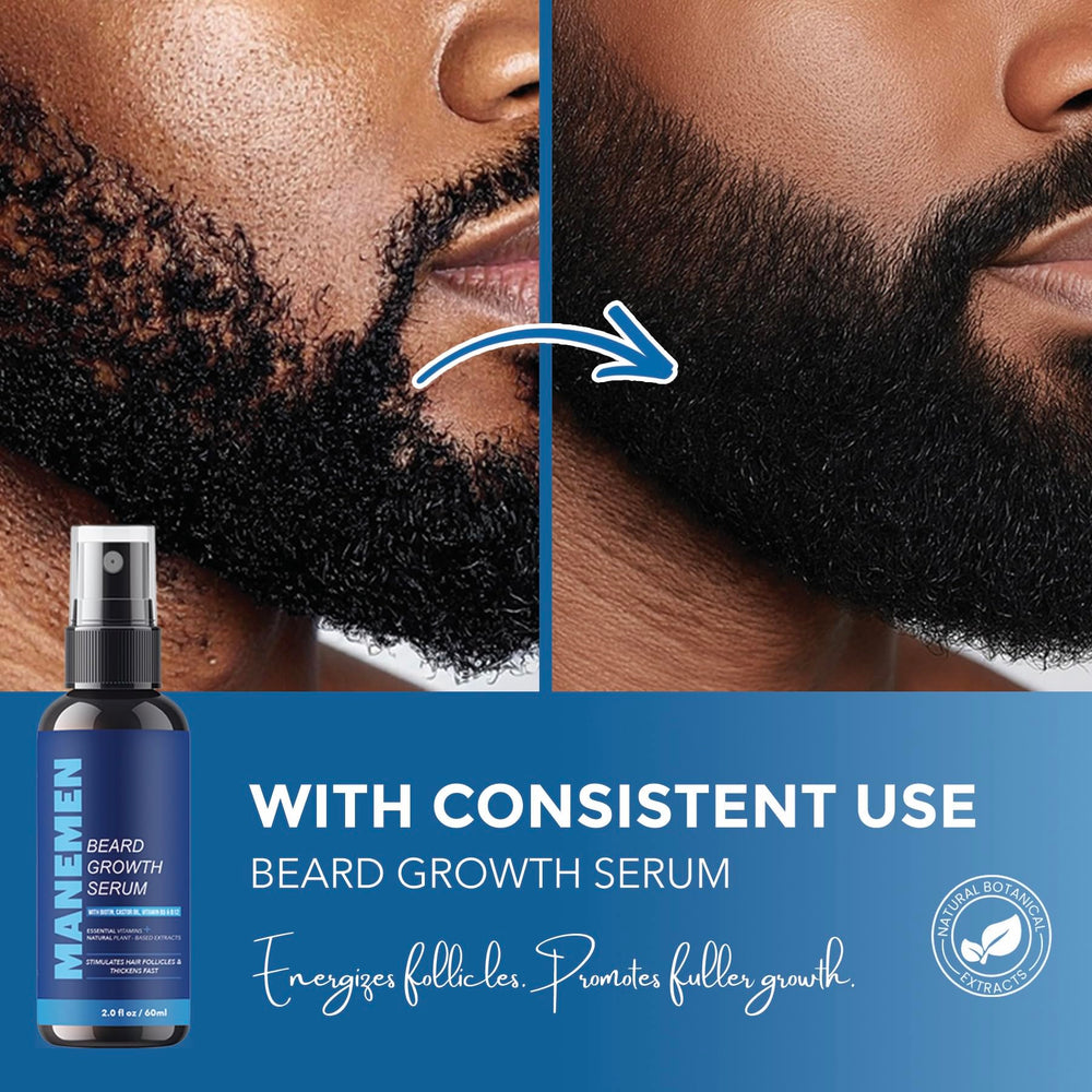 MANEMEN saw-palmetto-rosemary formula shows fortified beard roots.