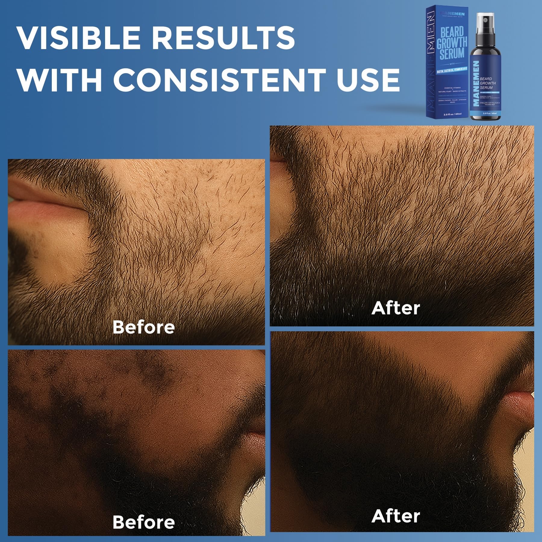 MANEMEN skin-soothing beard care suggests nourished skin with conditioning feel.