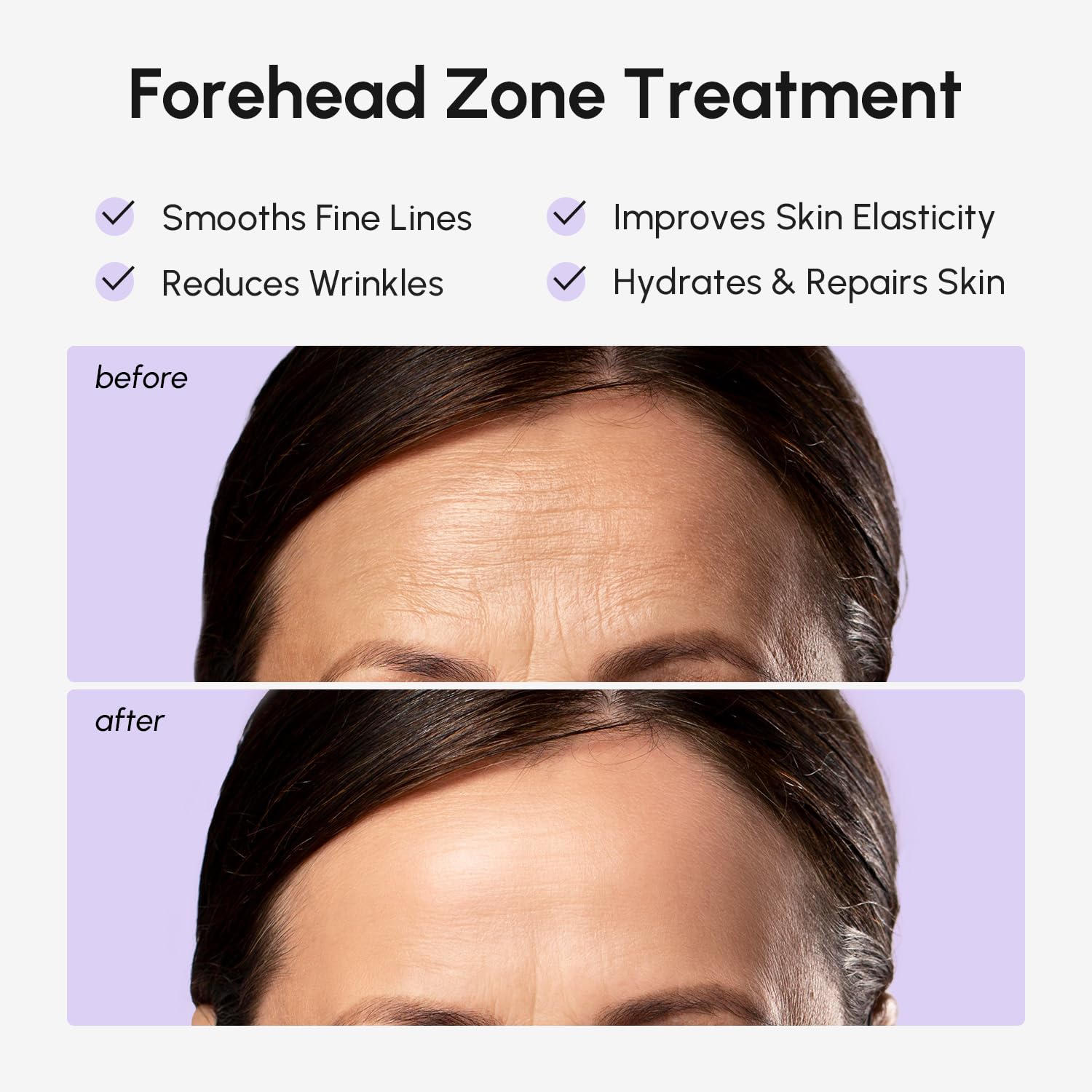 MAREE forehead patches hydrogel comfort with flexible fit across the brow