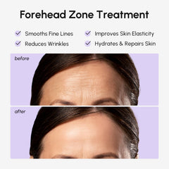 MAREE forehead patches hydrogel comfort with flexible fit across the brow