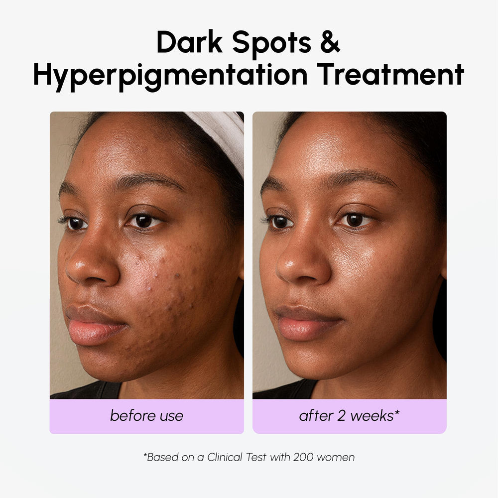 MAREE hyaluronic acid hydrates for a refreshed, comfortable finish