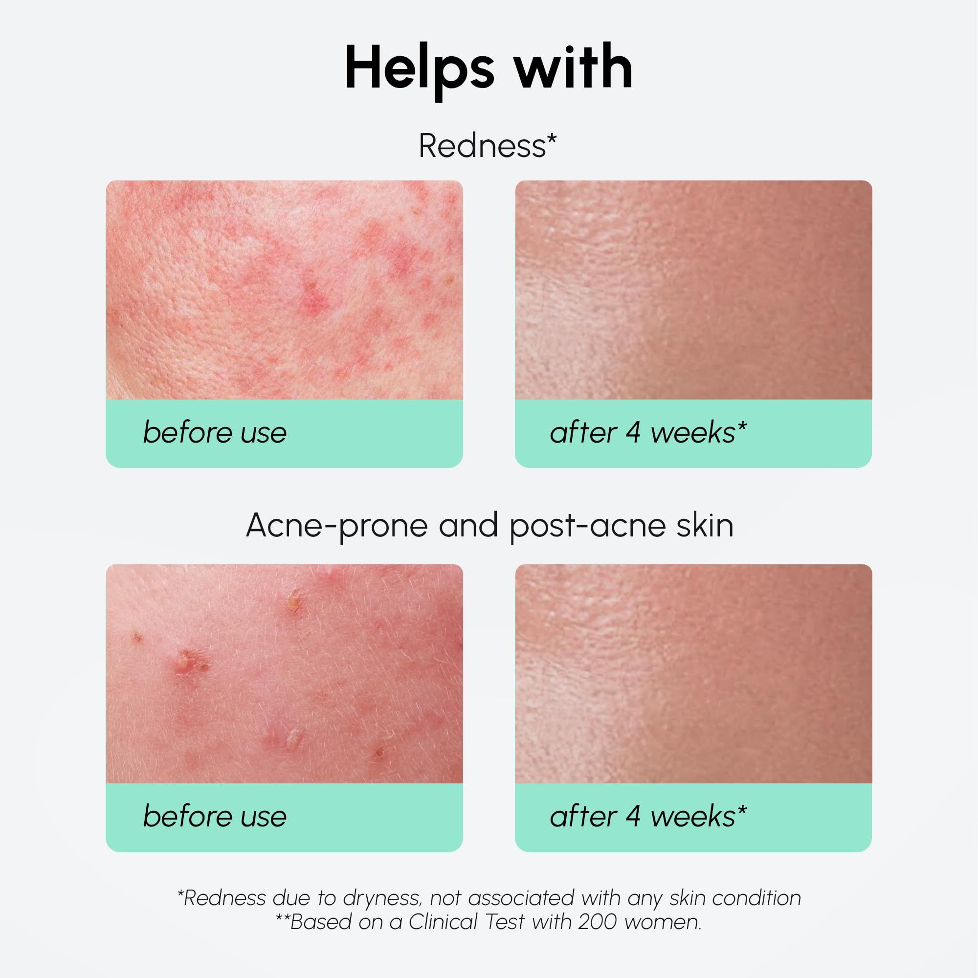 Graphic of Niacinamide, Centella Asiatica, and Hyaluronic Acid ingredients.