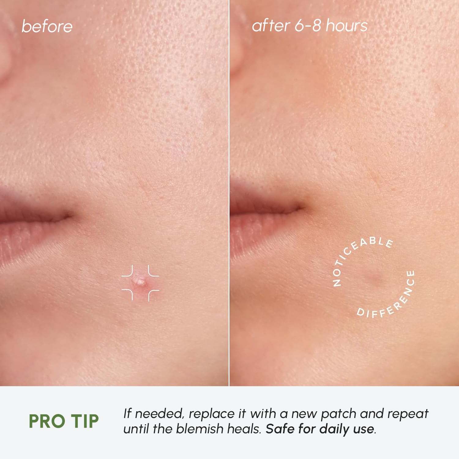 MAREE patches work under makeup or bare skin for flexible use.