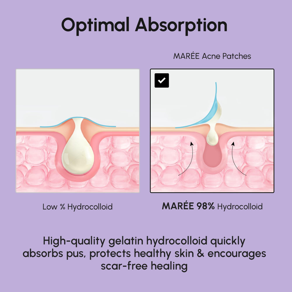 MAREE Star patches adhesive detail shows gentle sticking without irritation.