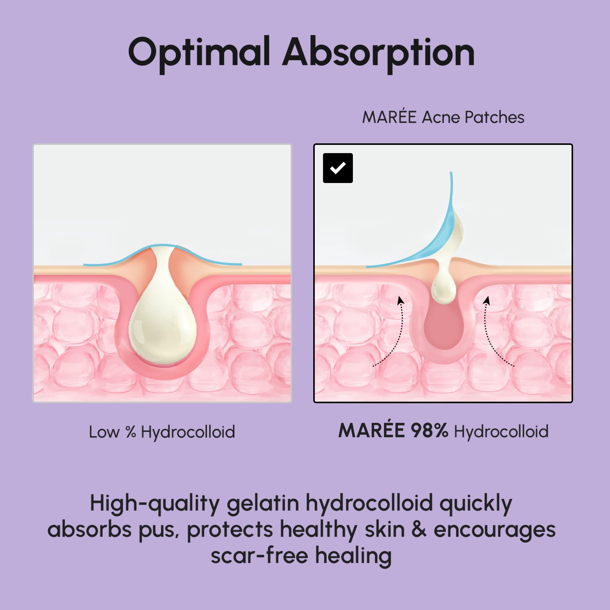 MAREE Star Pimple Patches feature waterproof breathable design for secure wear.