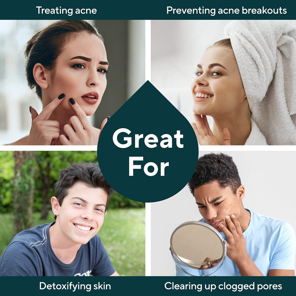 Marie Originals Acne Bar Soap packaging emphasizes USA craft and natural ingredients