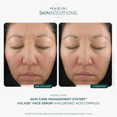 Marini SkinSolutions Hyla3D application view suggesting morning and evening use on the face and neck.