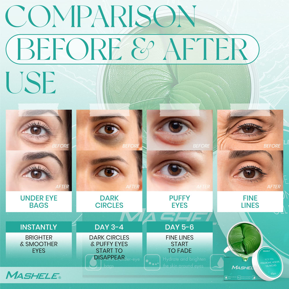 MASHELE Dark Circles and Puffiness Eye Patches help reduce bags and smooth skin.