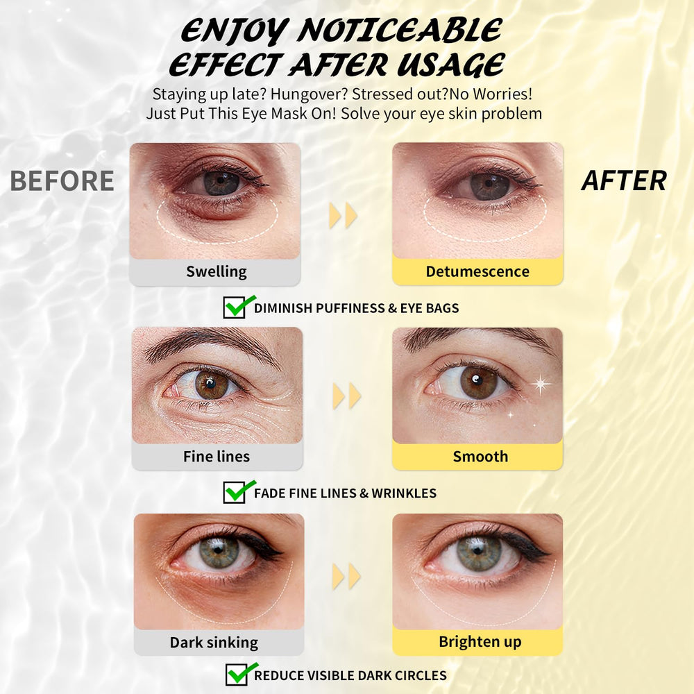 Maskiss pink caffeine eye masks reduce dark circles and awaken tired eyes.