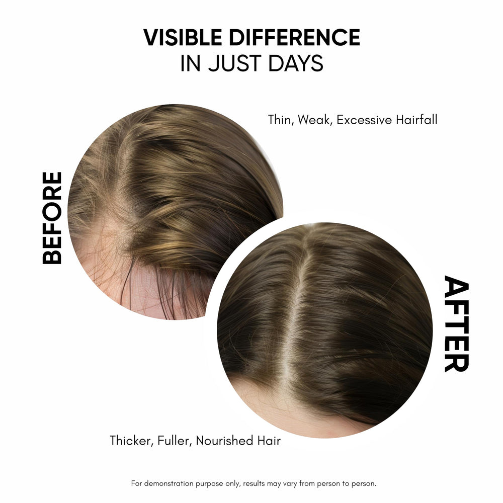 Masofta ingredients close-up highlights redensyl and capixyl blend.