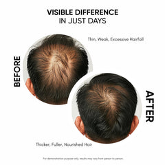 Masofta scalp application shows easy massage technique.