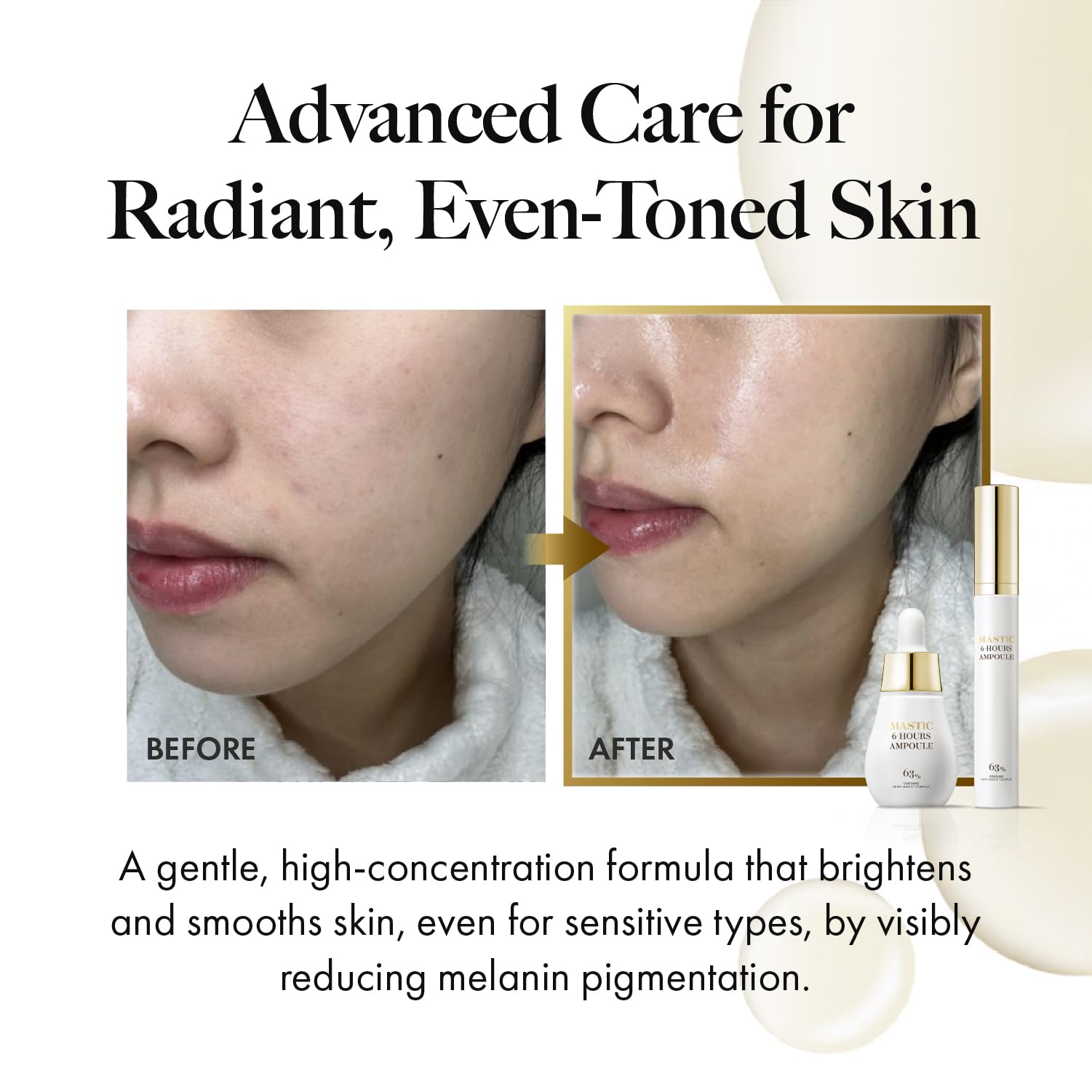 Fermented Mastic in Mastina Serum Roller improves absorption for delicate eye-area use.