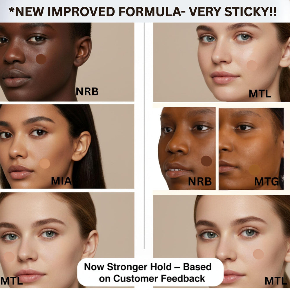 MATCHED Montreal small patch, 0.25 inch, discreet acne cover.