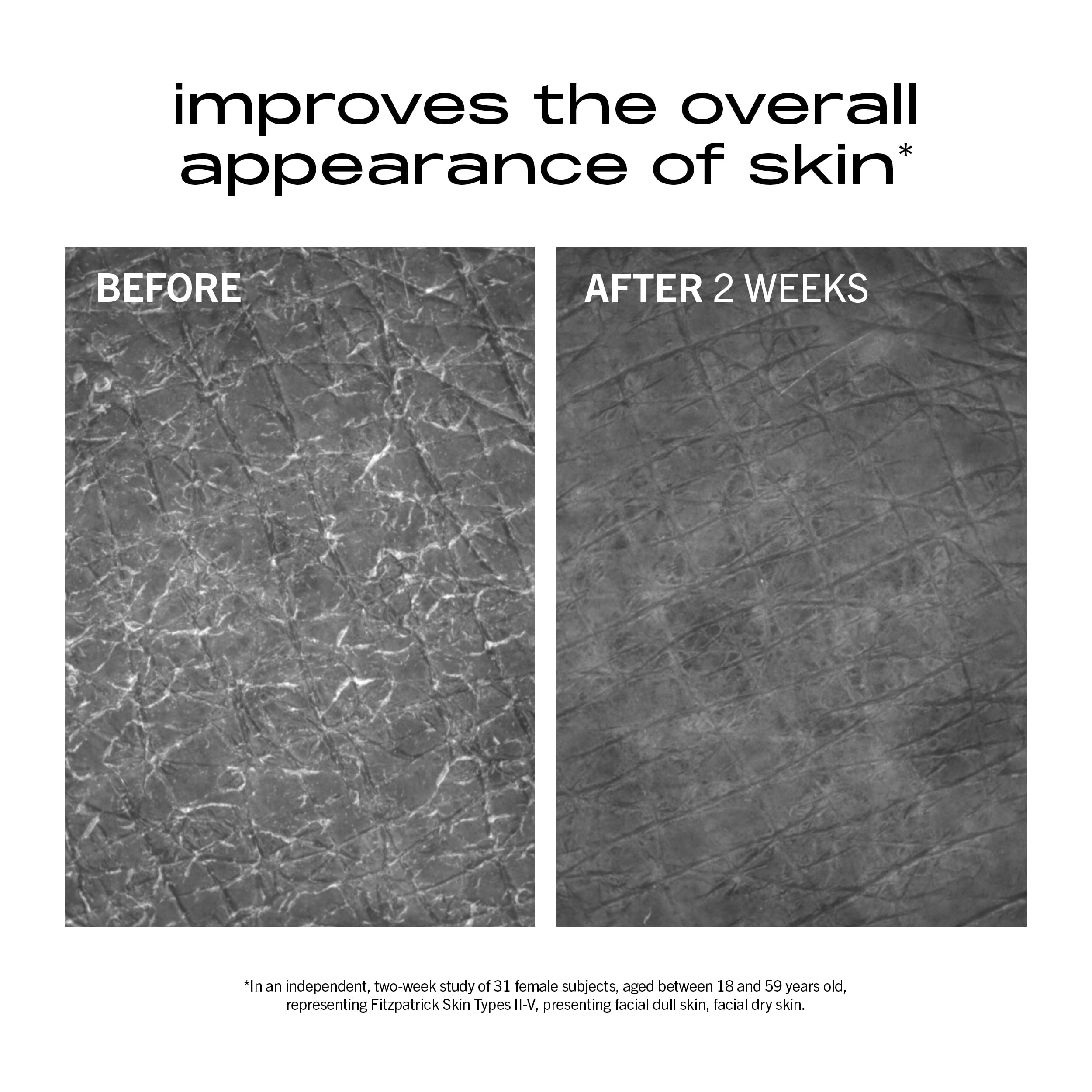 MATTER OF FACT Minimalist Hydrating Moisturizer liquid crystal lipids focus on barrier support.