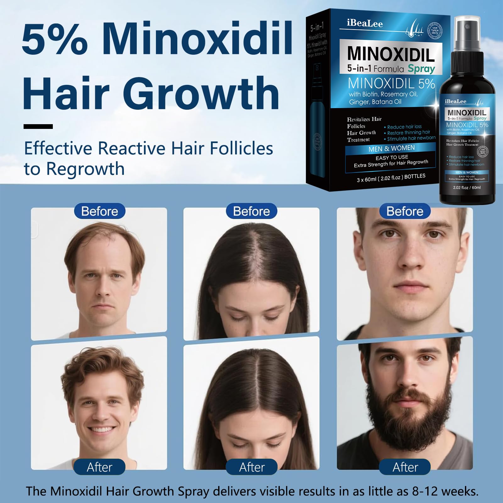 Mayferte Minoxidil spray in action for home use