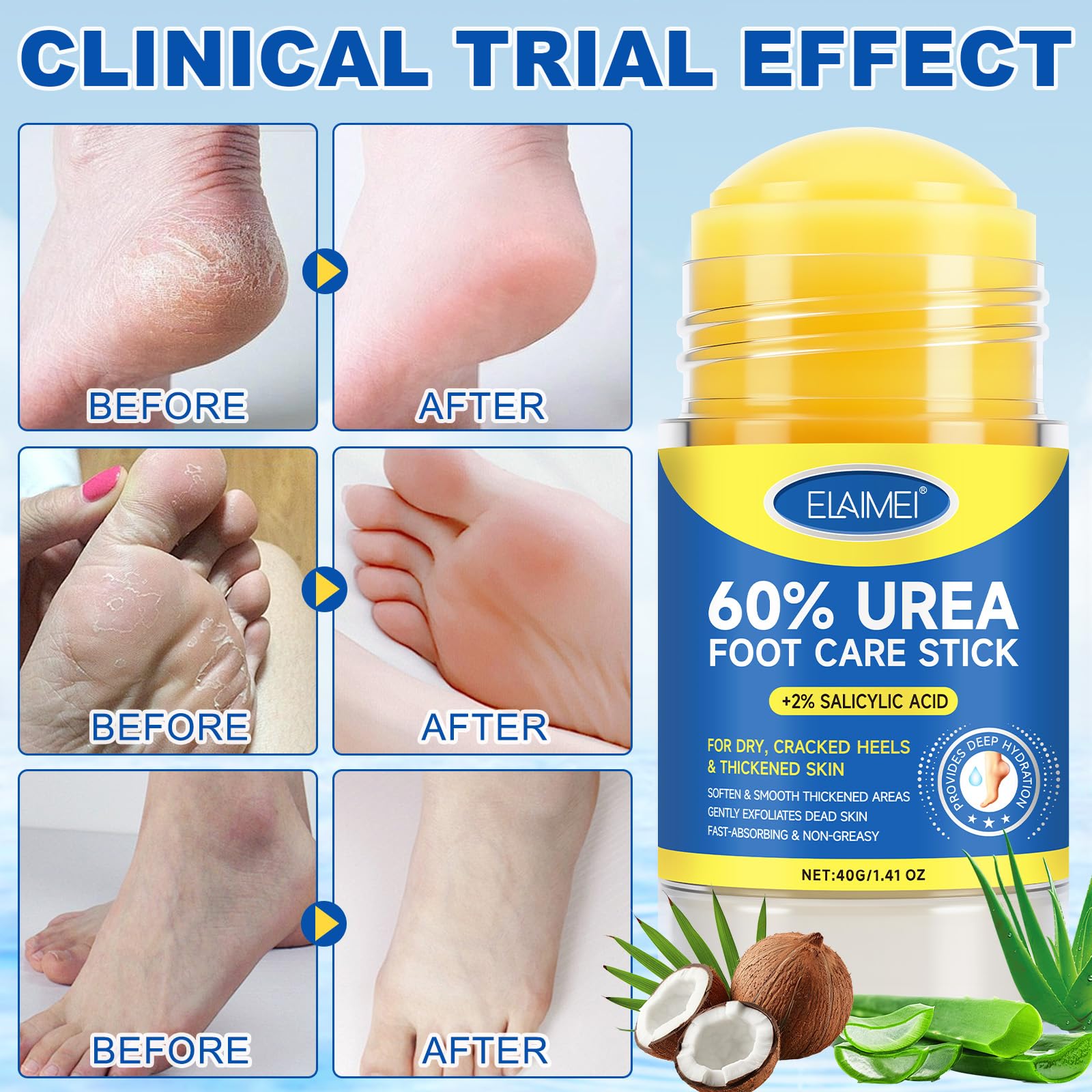 Mcukv Night Treatment thick layer applied with socks for deep repair