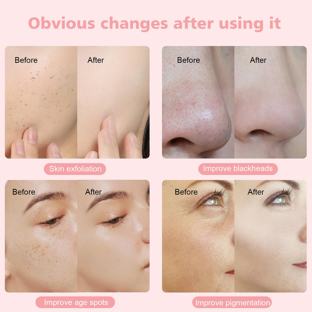 mcwdoit at-home skincare session promotes deeper cleansing and product absorption.