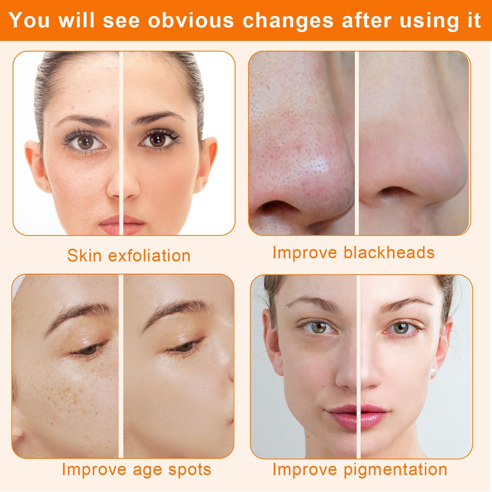 Mcwdoit Diamond Microdermabrasion Machine home-use setup suitable for spa-quality care at home