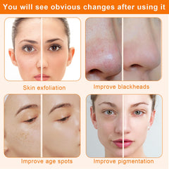 Mcwdoit Diamond Microdermabrasion Machine home-use setup suitable for spa-quality care at home