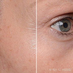 MD Complete Total Eye Treatment packaging front highlighting compact size