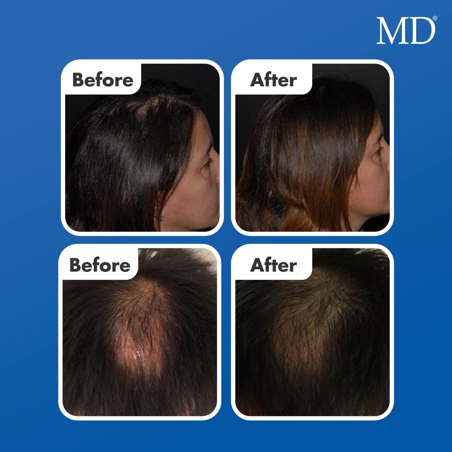 Ingredients panel highlighting biotin, peptides and DHT-blockers in Follicle Energizer.