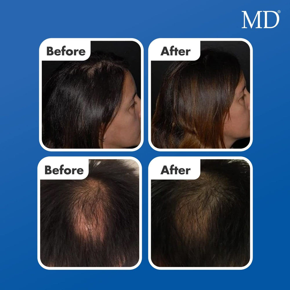 Ingredients panel highlighting biotin, peptides and DHT-blockers in Follicle Energizer.