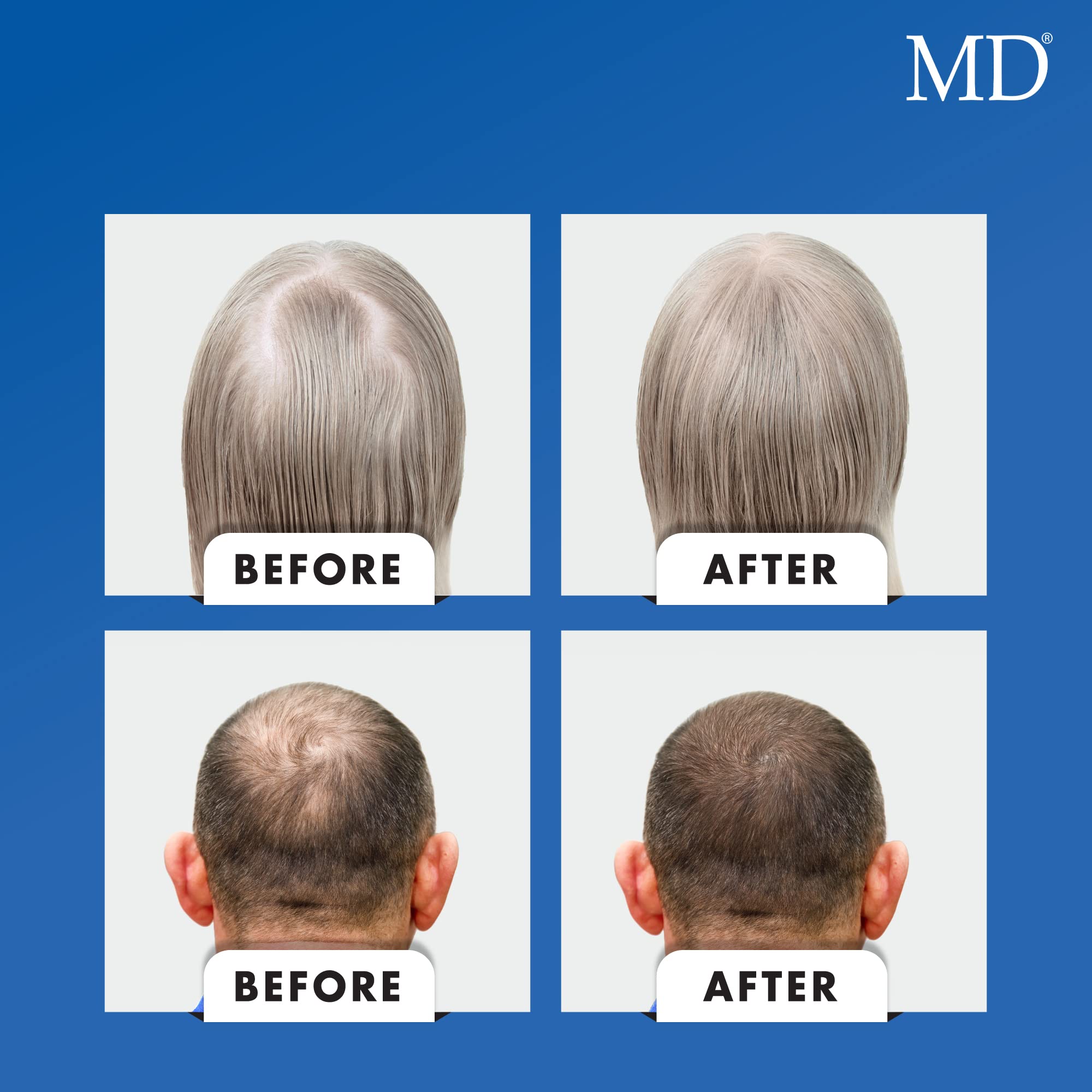 Close-up of hair strands to suggest fullness and resilience