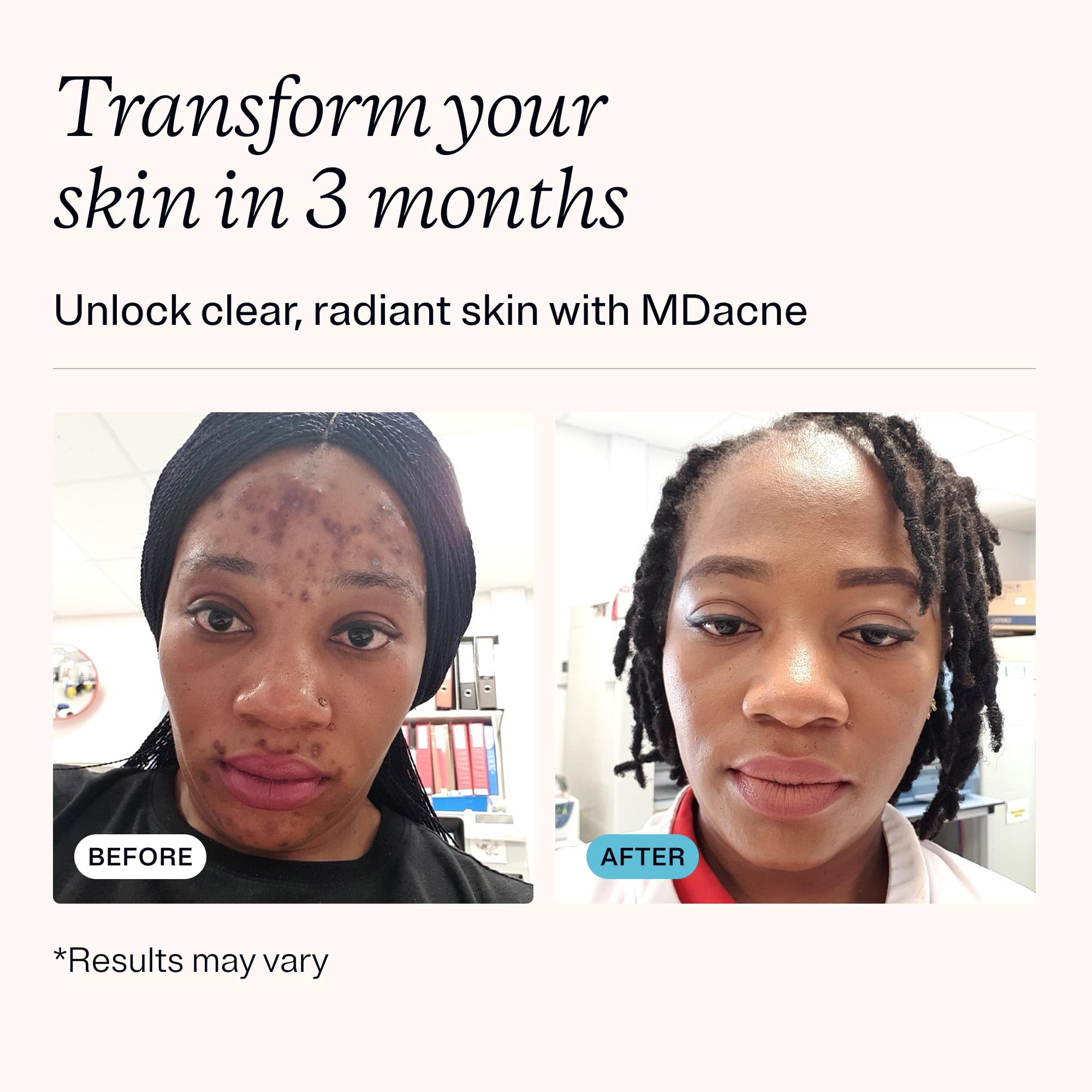 MDacne salicylic acid cleanser bottle emphasizes pore unclogging and oil control.