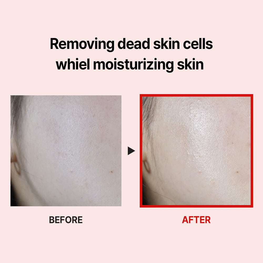 MDP premium packaging detail emphasizing collagen benefits and soothing formula