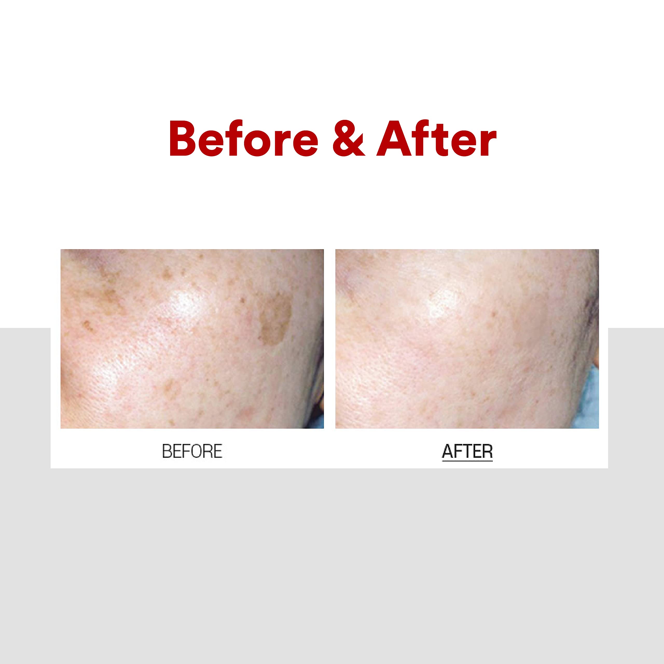 Medi-Peel Melanon X Cream application routine shows a lightweight, non-greasy finish.