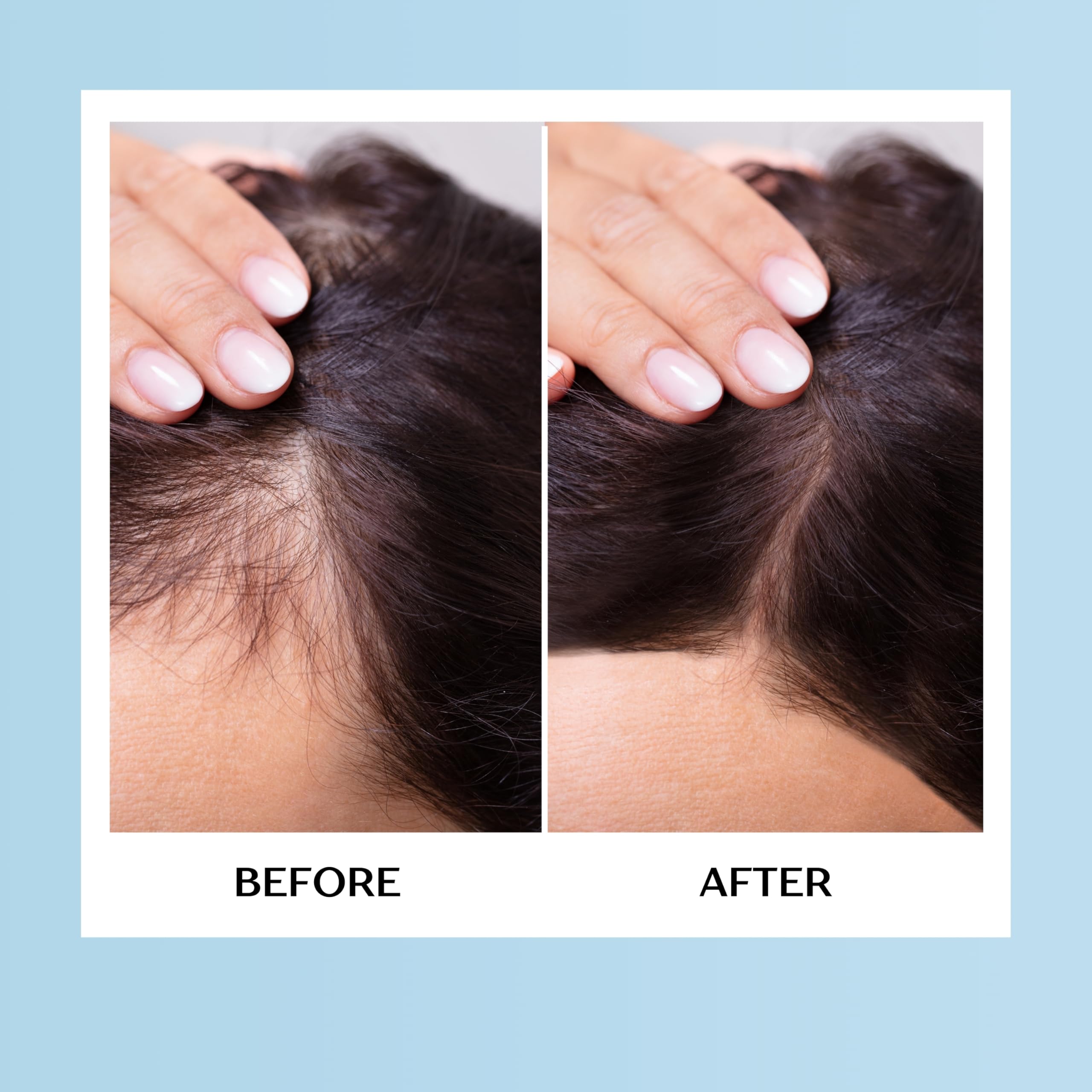 A woman uses Mediceuticals HairGain for a one-month supply routine.