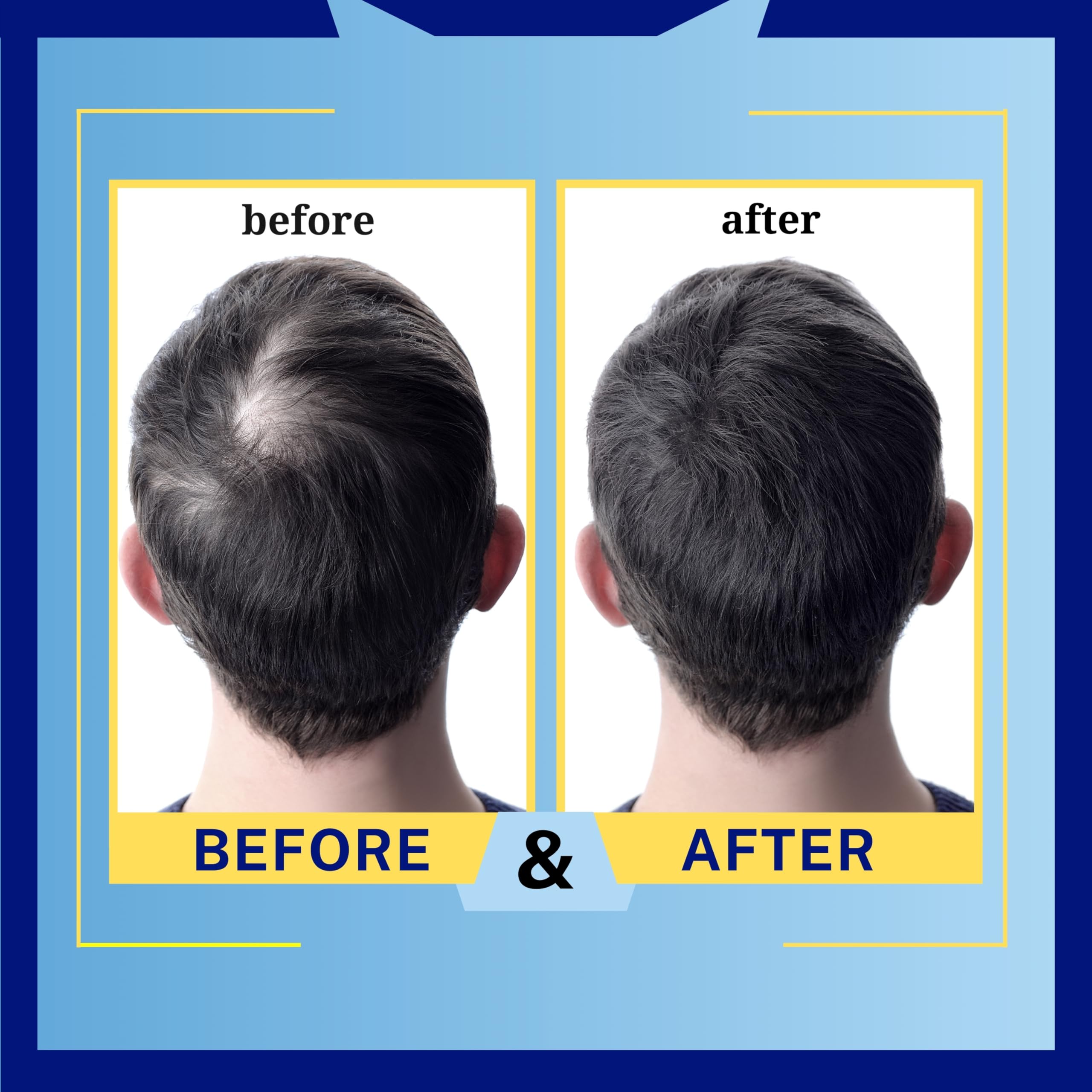 Mediceuticals HydroClenz scalp detail suggesting relief for dryness.