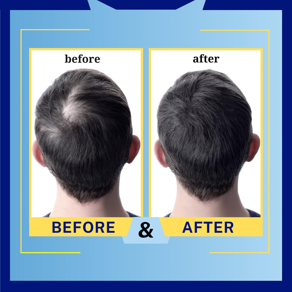 Mediceuticals HydroClenz scalp detail suggesting relief for dryness.