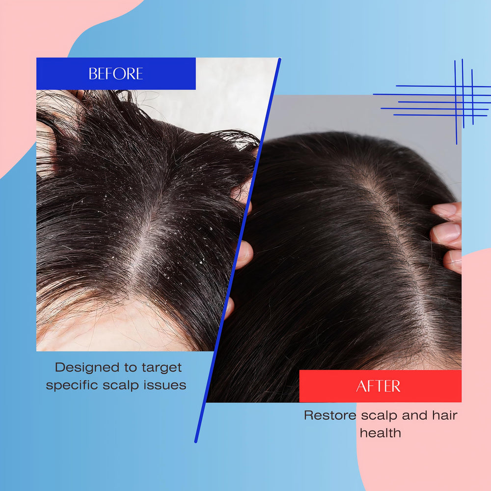 Mediceuticals Solv-X Shampoo after-use hair feels refreshed and less weighed down.