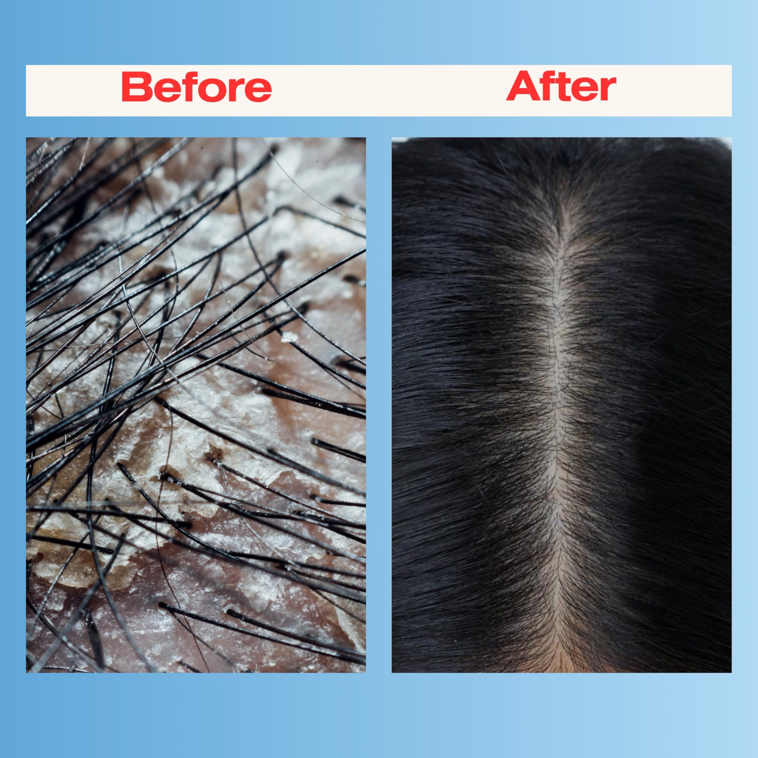 Mediceuticals Therapro scalp treatment in use during gentle massage