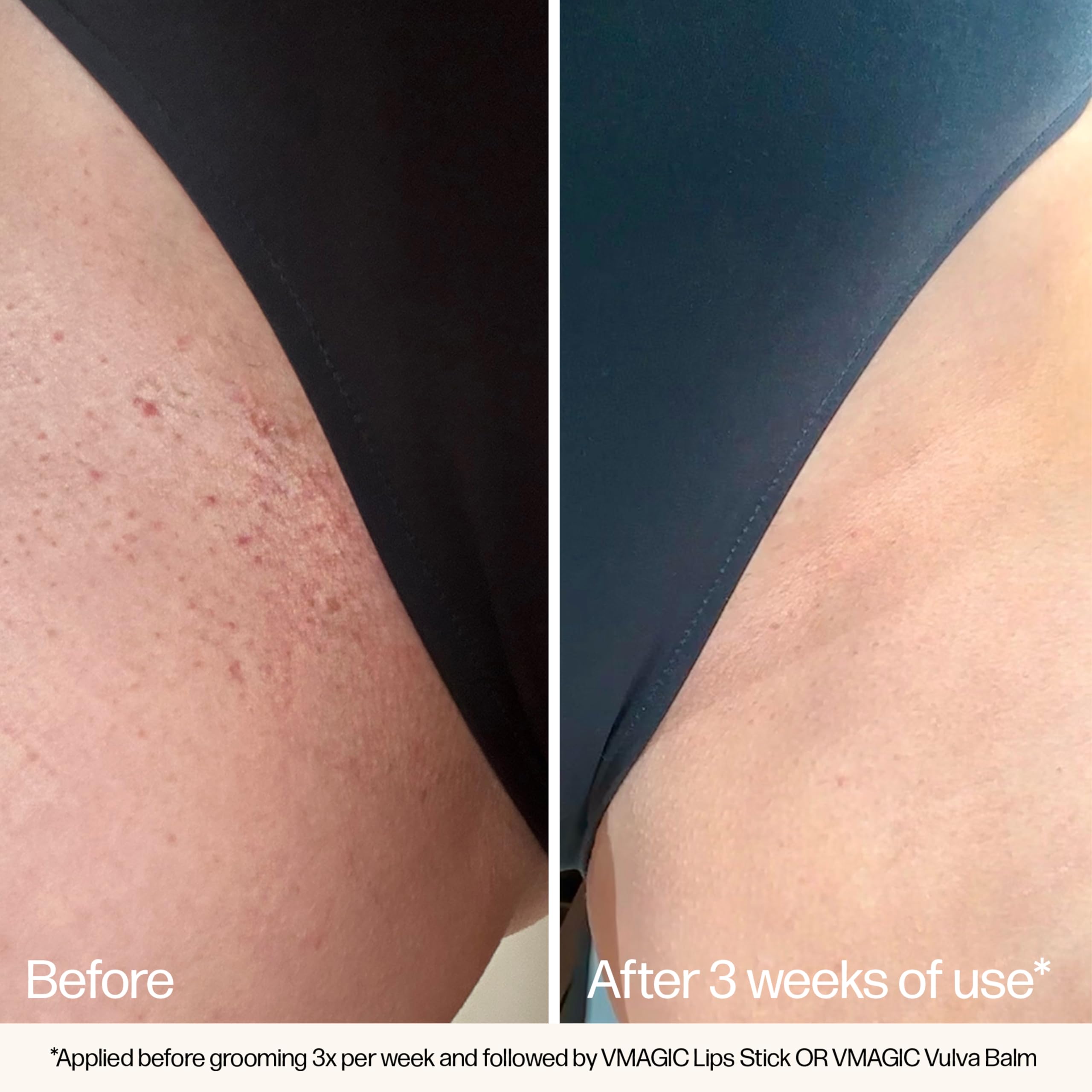 Organic borage seed oil in VMAGIC helps soften skin
