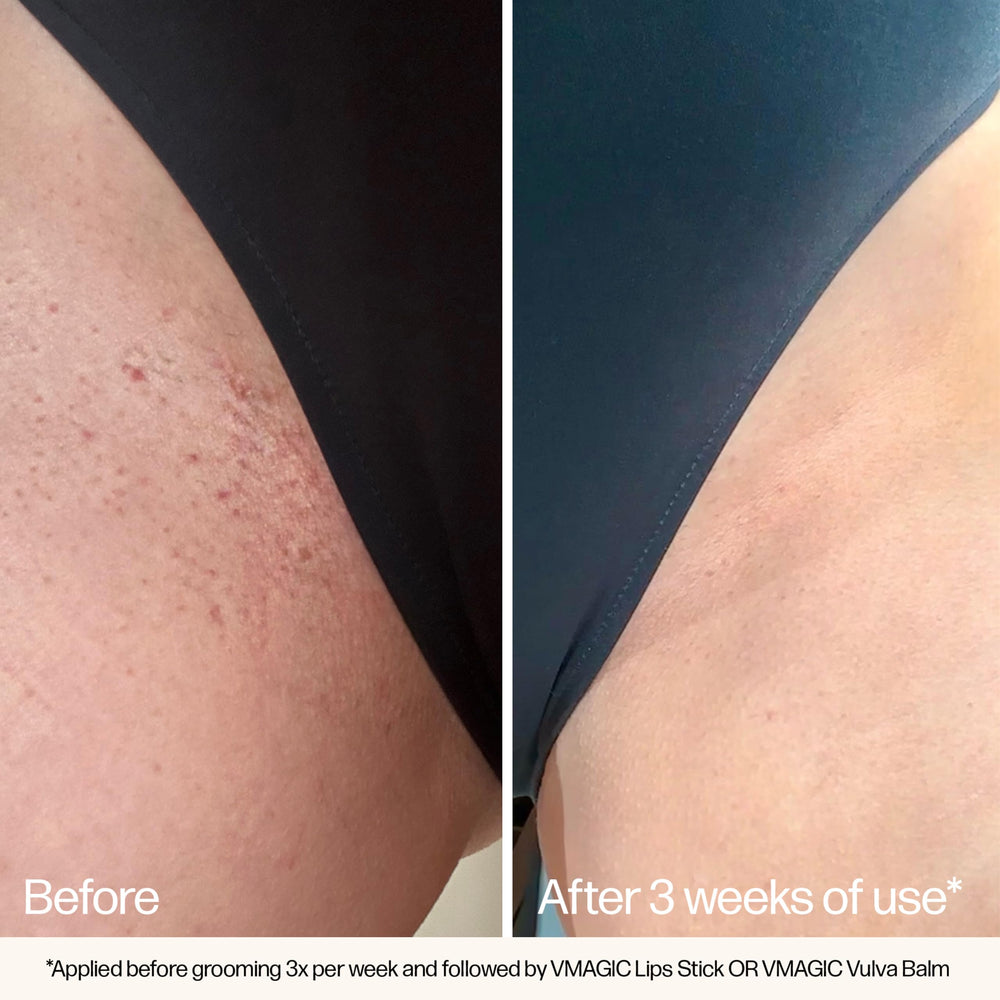 Organic borage seed oil in VMAGIC helps soften skin