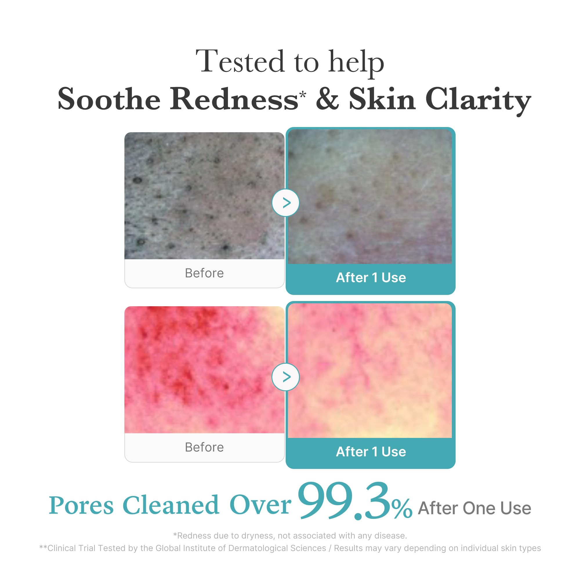 Medicube after-spot care context shows cleanser supporting pore refinement.